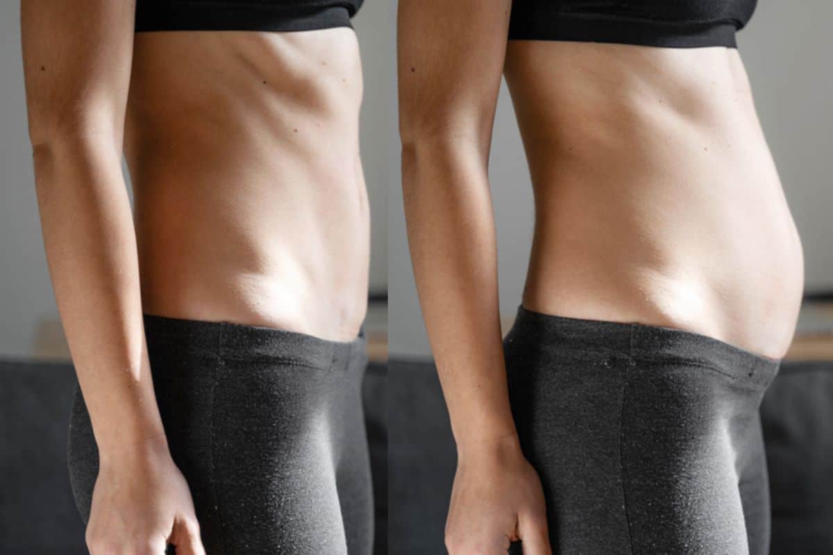 How long does diastasis recti take to improve Woking?