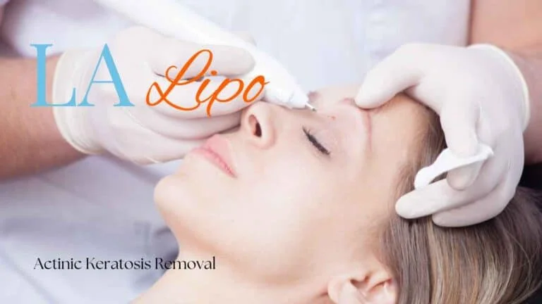 Woman receiving Actinic Keratosis Removal Treatment Woking