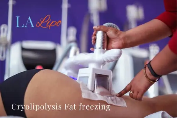 women getting fat freezing Woking