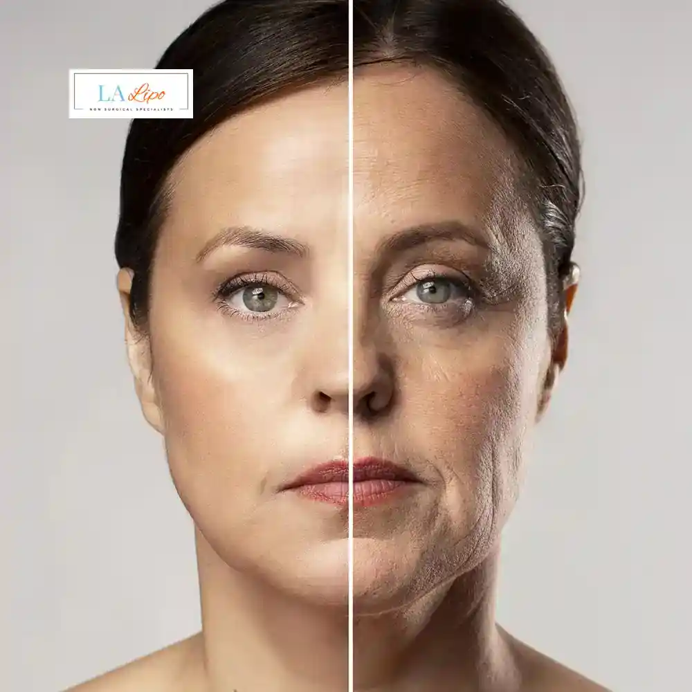 How Can You Tell If Non-Surgical Skin Tightening Is Right for You Woking?