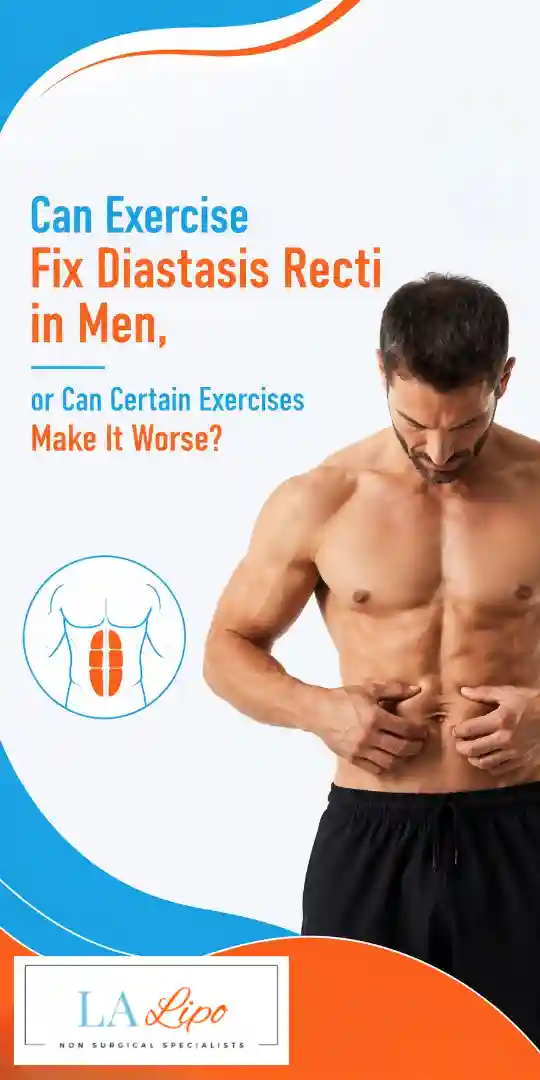 Can Exercise Fix Diastasis Recti in Men, or Can Certain Exercises Make It Worse Woking?